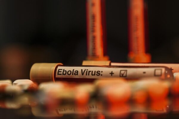 Ebola alarmı: Vaka sayısı 7 bini aştı